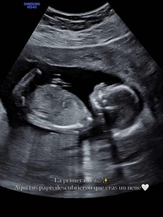 Instagram post from centrosmomentum. This post is in position 1.